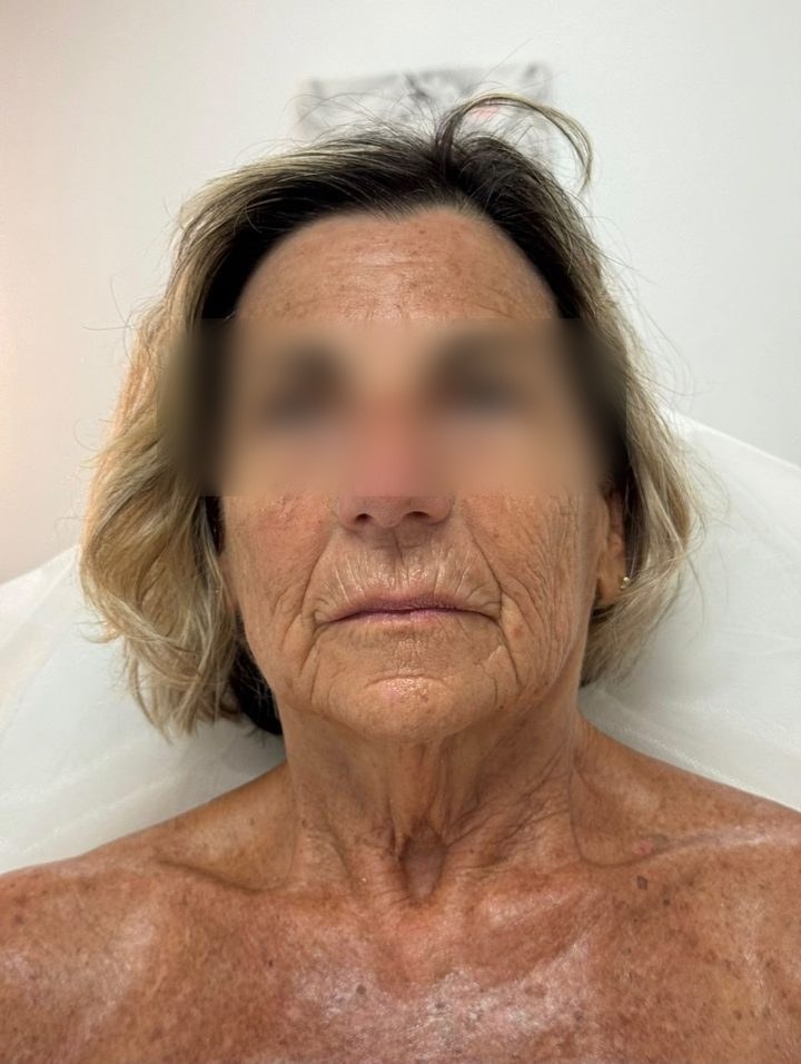 The same client after treatment
