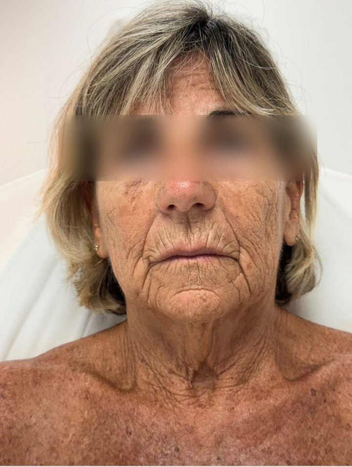 Client before treatment